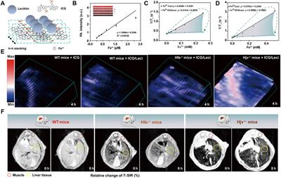 Metal Ion-Based Supramolecular Self-Assembly for Cancer Theranostics